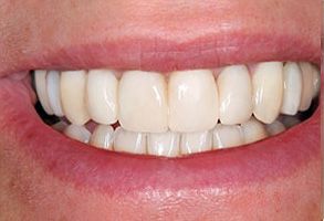 Elegant Dental Arts | Dentures, All Services and Emergency Treatment