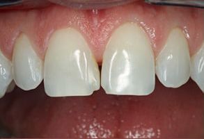 Elegant Dental Arts | CBCT, Dental Cleanings and Emergency Treatment